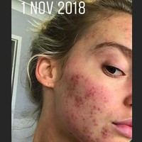 Georgia lebih banyak makan sayur dan buah. Dia tidak makan biji-bijian, makanan pengawet, kafein, gula untuk mengatur ulang ususku. Foto: Instagram