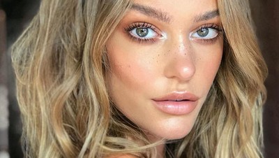 Foto: Penampakan Model Cantik yang Tiba-tiba Jerawatan Parah
