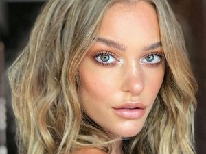 Foto: Penampakan Model Cantik yang Tiba-tiba Jerawatan Parah