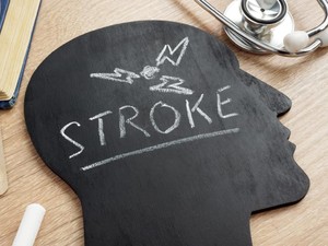Ancaman Kematian dan Kecacatan karena Stroke