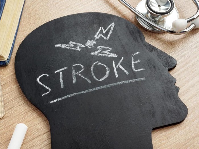 Hari Stroke Sedunia dan Sejarahnya yang Diperingati Tiap 29 Oktober