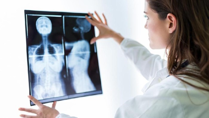 Cerita Nenek Didiagnosis Kanker Payudara di Umur 100 Tahun, Begini Kondisinya