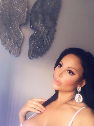 Gila Oplas, Wanita Ini Operasi di Area Intim Agar Punya 'Vagina Barbie'