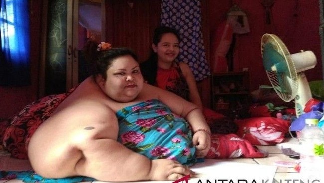 Pola Makan Penderita Obesitas Hingga Aksi Barbar Juru Masak