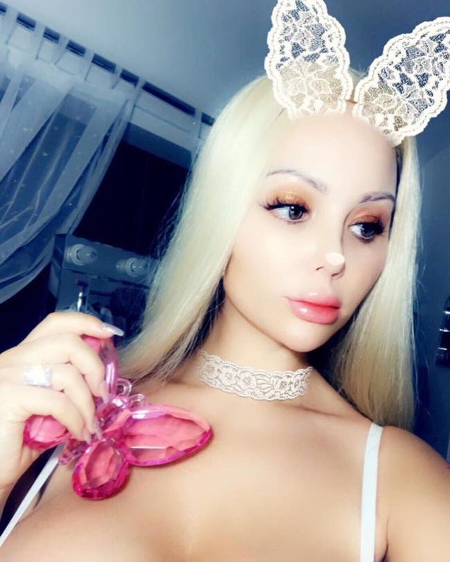 Menurut Delguidice, operasi plastik bernama vaginoplasty itu bisa mengencangkan dan merapatkan area kelaminnya. Delguidice pun mengatakan bahwa ia ingin menyamakan area pribadinya itu dengan milik Barbie. Delguidice pun ingin mendapatkan kesempurnaan area intim dengan melakukan vaginoplasty keempat kalinya.  Foto: dok. Instagram