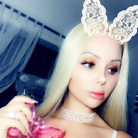 Menurut Delguidice, operasi plastik bernama vaginoplasty itu bisa mengencangkan dan merapatkan area kelaminnya. Delguidice pun mengatakan bahwa ia ingin menyamakan area pribadinya itu dengan milik Barbie. Delguidice pun ingin mendapatkan kesempurnaan area intim dengan melakukan vaginoplasty keempat kalinya.  Foto: dok. Instagram