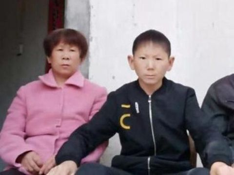 Cedera Kepala Saat Kecil Bikin Pria 34 Tahun Jadi Berwajah Anak-anak