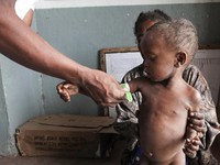 Sedih! Ini 5 Negara yang Dilanda Kelaparan Paling Ekstrem di Dunia