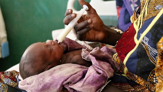 Sedih! Ini 5 Negara yang Dilanda Kelaparan Paling Ekstrem di Dunia