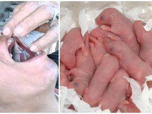 Makan Undur-undur hingga Bayi Tikus, Ini 5 Tradisi Pengobatan Unik