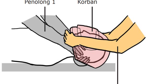 Jangan Asal Buka Helm Korban Laka Lantas