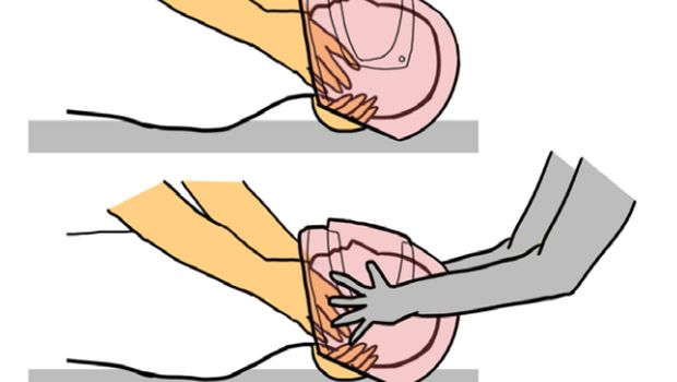 Jangan Asal Buka Helm Korban Laka Lantas