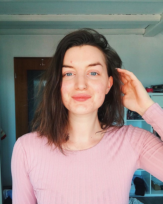 Hal tersebut berdasarkan pengalamannya sendiri yang juga pernah berjerawat parah. Dua tahun lalu, Lea mulai berjerawat ketika mengkonsumsi pil KB. Ia pun menemukan sebuah metode mindset yang dikatakan dapat menyembuhkan kulit dari dalam. Foto: Instagram @skinwithlea