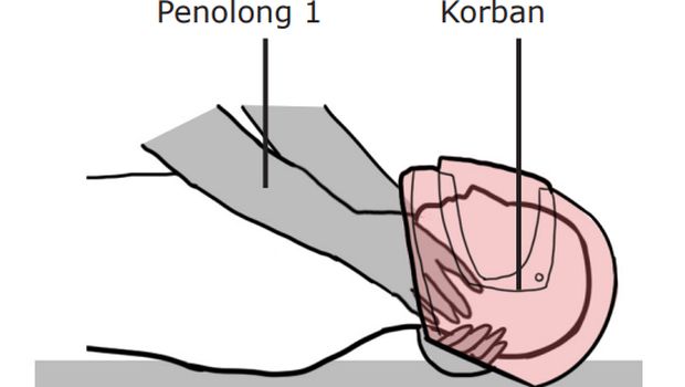 Jangan Asal Buka Helm Korban Laka Lantas