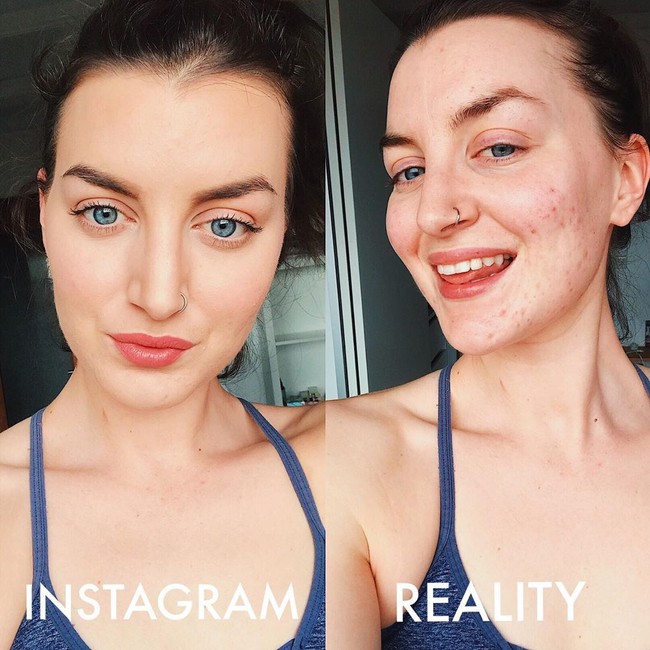 Lea Alexandra dikenal di Instagram sebagai pakar mindet yang khusus membantu para wanita berjerawat. Tujuannya adalah untuk mengajarkan wanita bagaimana cara menjadi lebih percaya diri dan bebas dari rasa khawatir, stres, dan kecemasan karena kulit mereka. Foto: Instagram @skinwithlea