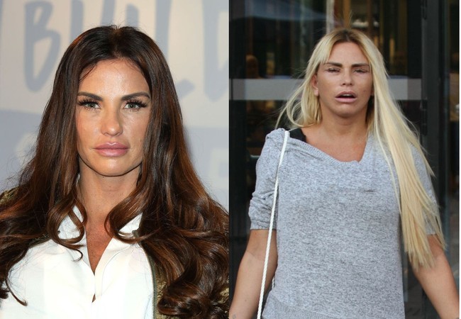 Bintang reality show paling kontroversial di Inggris Katie Price kerap kali melakukan operasi plastik. Pasca bedah plastik, wajah wanita 41 tahun itu lebih bengap.  Foto: Getty Images, Istimewa
