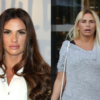Bintang reality show paling kontroversial di Inggris Katie Price kerap kali melakukan operasi plastik. Pasca bedah plastik, wajah wanita 41 tahun itu lebih bengap.  Foto: Getty Images, Istimewa