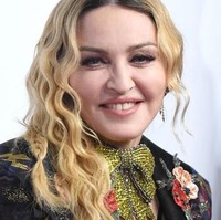 Madonna disebut sebagai wanita yang ingin melawan penuaan. Sejumlah pakar kecantikan menyebut bahwa wajah Madonna yang terkadang terlihat bengkak adalah hasil dari filler. Kebanyakan filler bisa menyebabkan wajah klien jadi bengkak, tidak natural dan terlihat tua, ujar Katherine Millar-Shannon, suster yang biasa mendampingi dokter bedah plastik.  Foto: AFP