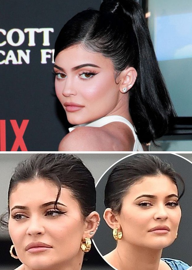 Sejumlah artis Hollywood pun pernah tiba-tiba muncul dengan wajah yang lebih bengkak. Kylie Jenner misalnya, pada perayaannya yang ke-22 pada Agustus silam, wajahnya tampak membengkak. Netizen pun mengkritik penampilannya yang dinilai kebanyakan botox dan filler sehingga malah tampak seperti wanita 40 tahun.  Foto: Getty Images, Istimewa.