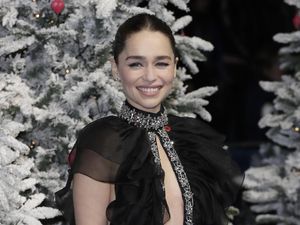 Bintang Game Of Thrones Mengaku Kehilangan Sedikit Otaknya karena Aneurisma