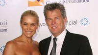 Yolanda Hadid melakukan beragam operasi selama hidupnya itu. Frederick M. Brown/Getty Images