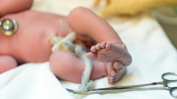 tali pusar Photo of a new born baby where the focus is on feet and toes. The umbilical cord is there with surgical scissors attached. The face of the baby is not in the photograph. Body color is pink and feet are slightly purple.
