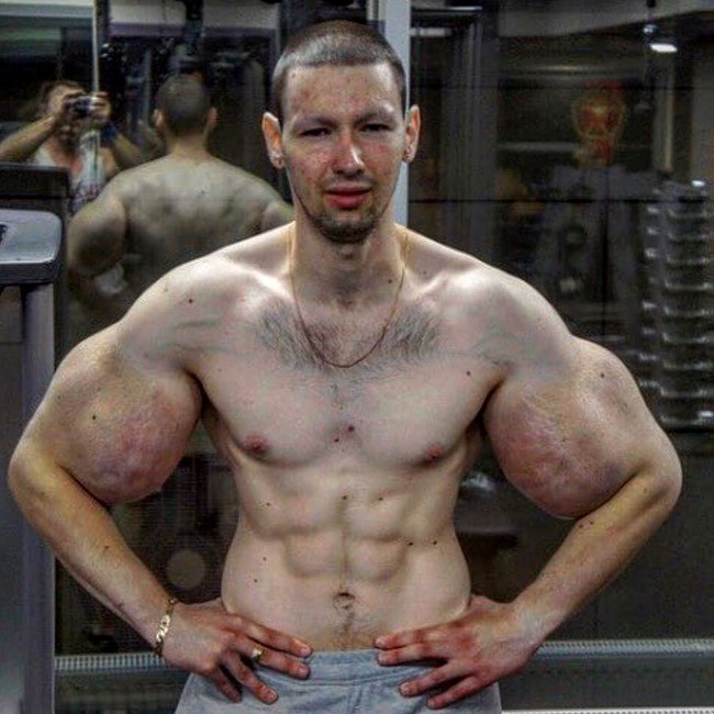 Kirill diketahui telah menjalani berbagai operasi plastik dan tindakan kecantikan. Alasannya bukan karena ingin tampil sempurna tapi sebagai usahanya untuk bertemu dengan alien.Foto: instagram @ubonad