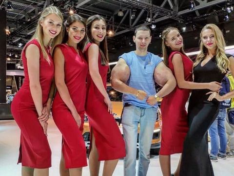 Pria Ini Terobsesi Mirip Popeye, Berakhir Tragis karena Ototnya Jadi Busuk