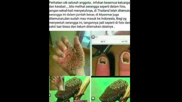 Hoax efek gigitan serangga yang bikin tangan bolong. Foto: Tangkapan layar Facebook Hoax efek gigitan serangga yang bikin tangan bolong. Foto: Tangkapan layar Facebook