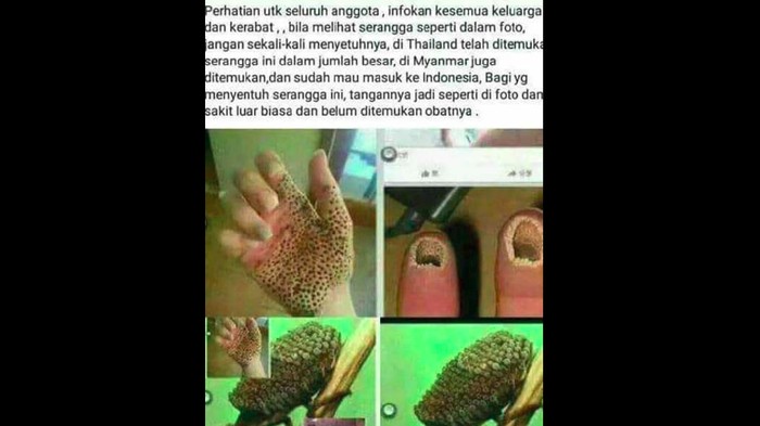 Hoax efek gigitan serangga yang bikin tangan bolong. Foto: Tangkapan layar Facebook