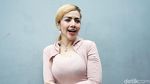 Barbie Kumalasari Curhat Ada Benjolan, Netizen Salfok ke Bibirnya