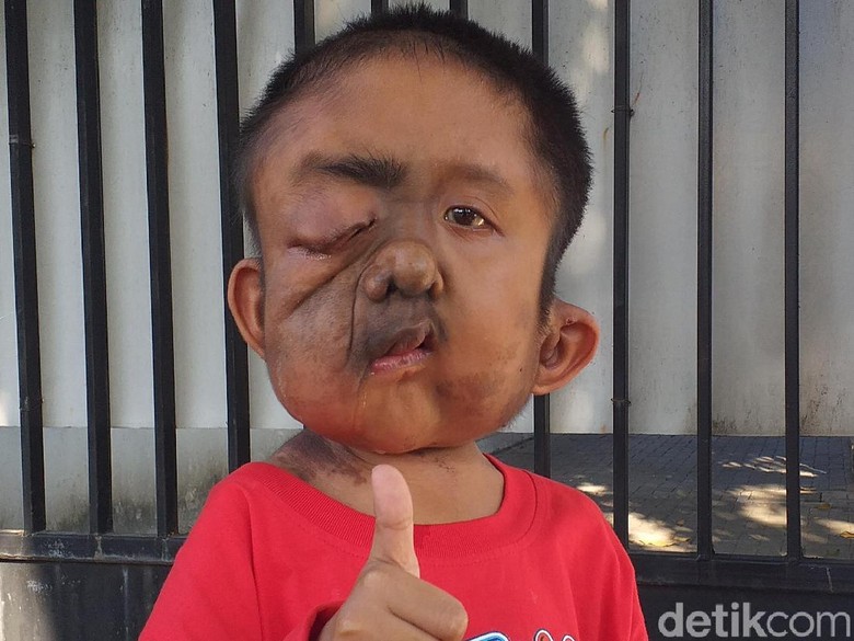 Bocah Yatim Piatu Ini Putus Sekolah Sejak Idap Empat Jenis Kanker dan Tumor Bocah Yatim Piatu Ini Putus Sekolah Sejak Idap Empat Jenis Kanker dan Tumor