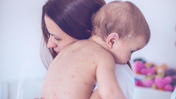 509106504 Mother nursing sick child At Home