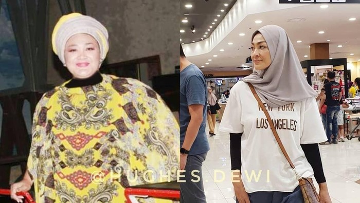 Before-After Dewi Hughes yang Turun 90 Kg dengan Hipnoterapi