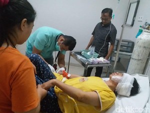 Pipi Perempuan di Makassar Robek Digigit Anjing Pitbull