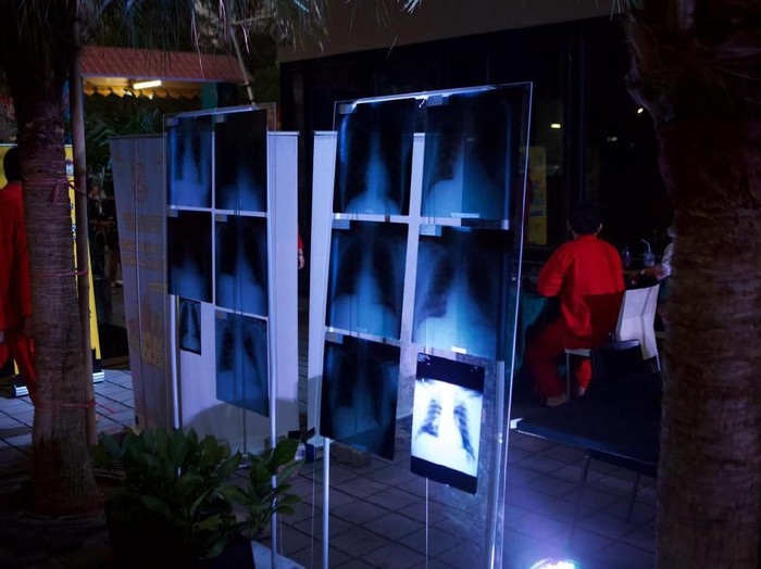Deretan foto rontgen paru yang dipamerkan para pengguna vape atau rokok elektrik (Foto: Andika Widhi/Hexohm Indonesia) Deretan foto rontgen paru yang dipamerkan para pengguna vape atau rokok elektrik (Foto: Andika Widhi/Hexohm Indonesia)