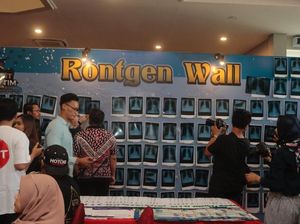 Vaper Pamer Foto Rontgen Paru-paru, Kenapa Tak Hitam Seperti Perokok?