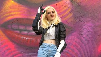 Tilly mengaku ingin dapat berguna bagi banyak orang, terutama orang dengan amputasi atau amputee. Foto: Instagram/tilly.lockey