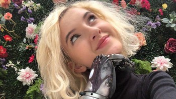 Ini (tangan bionik --red) membantuku setiap hari, karena tentunya memiliki double amputee kamu harus menggunakan kedua tangan bersamaan, jadi aku nggak bisa multitask seperti masak, sekarang aku sudah bisa seperti bikin cokelat panas, melakukan berbagai hal bersamaan, ujarnya kepada detikcom. Foto: Instagram/tilly.lockey