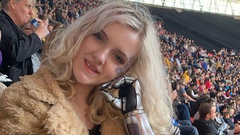 Sosoknya sangatlah periang dan hangat. Foto: Instagram/tilly.lockey