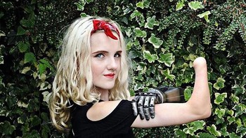 Ia kehilangan kedua tangannya ketika masih bayi usia 15 bulan karena Meningitis Septicaemia. Foto: Instagram/tilly.lockey