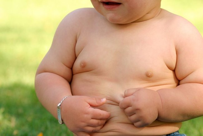 Hindari Memberi 5 Makanan Ini pada Si Kecil agar Tak Obesitas