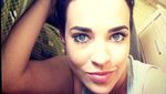 Ini Stephanie Davis, Aktris yang Ngaku Dibully karena Jidatnya