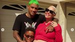 Pilih Sedot Lemak usai Melahirkan, Ini Penampilan Lama Amber Rose