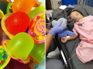 Tersedak Jelly, Bayi 1 Tahun Ini Meninggal Dunia