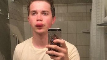 Mas-mas ini pegawai di peternakan lebah. Duh perih lihat bibirnya... (Bored Panda)