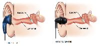 Mengenal Jenis-jenis Headphone, Ada Apa Saja Sih?