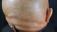Bila melihat lebih dekat lagi, tidak hanya menyerupai kepala manusia dengan gaya rambut botak. Ternyata di sisi kiri dan kanan lengkap dengan bentuk telinga. Foto: Dok. Motosaigon