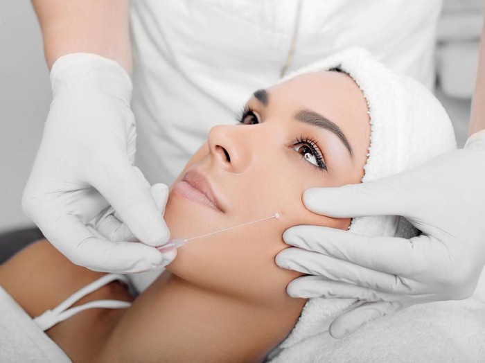 Tanam benang cropped woman face getting facelift , procedure mesothreads lifting skin