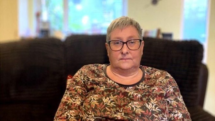 Alergi lateks sangat mempengaruhi kehidupan Liz. (Foto: BBC) Alergi lateks sangat mempengaruhi kehidupan Liz. (Foto: BBC)